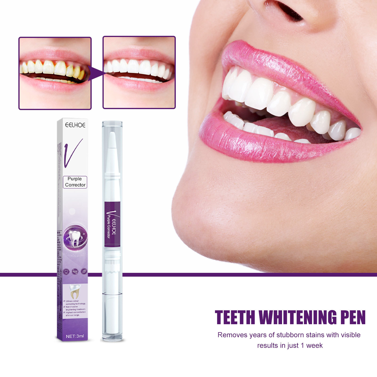 Whitening Pen Bleach - Pena Pasta Gigi Pemutih Gigi Ungu