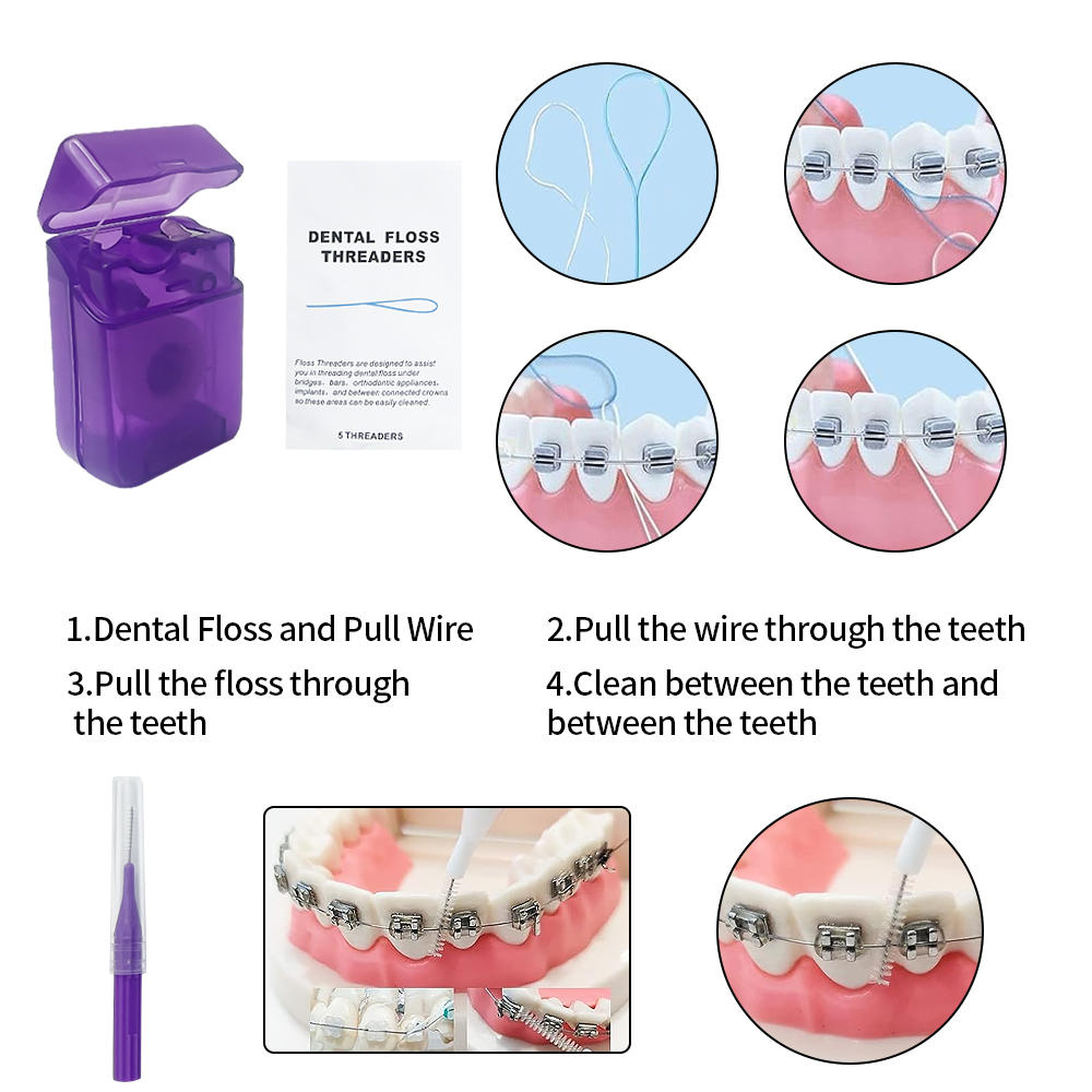 Kit sikat gigi, perawatan gigi - Teeth Whitening With Braces ulasan dan harga