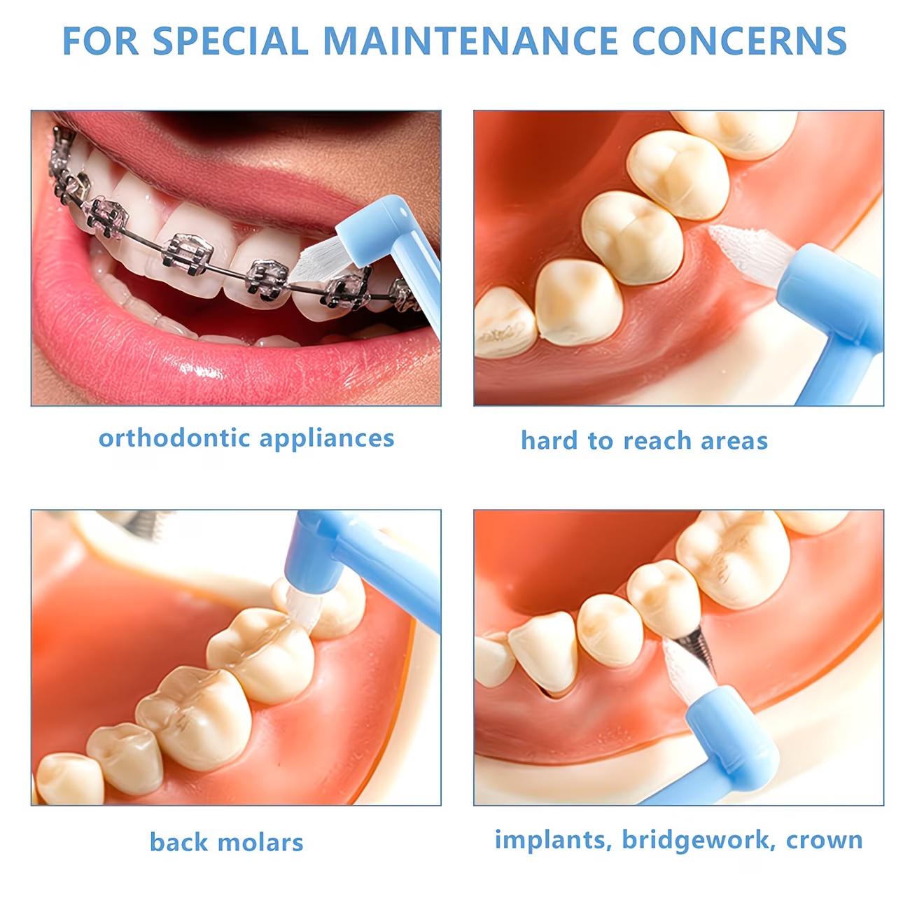 1/3 Buah Sikat Gigi Kawat Gigi - Teeth Whitening With Braces ulasan dan harga
