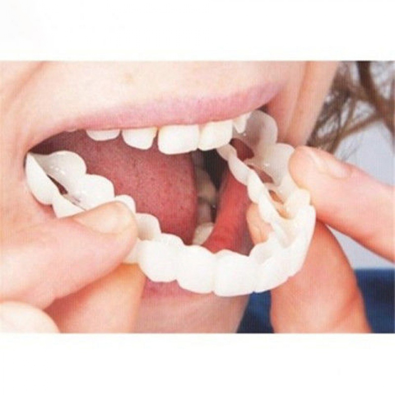 Penutup Gigi Palsu Cocok Sempu - Teeth Whitening With Braces ulasan dan harga
