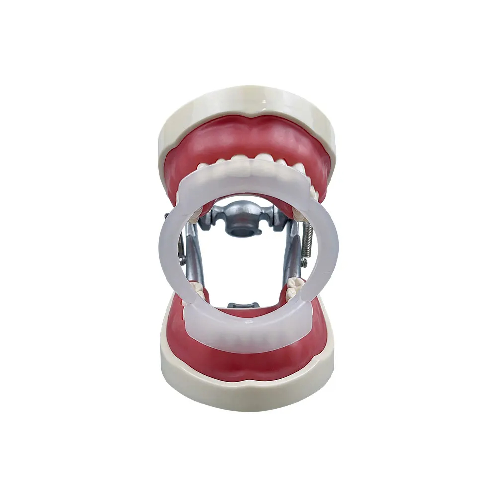 100pcs/bag Retraktor Bibir & P - Teeth Whitening With Braces ulasan dan harga