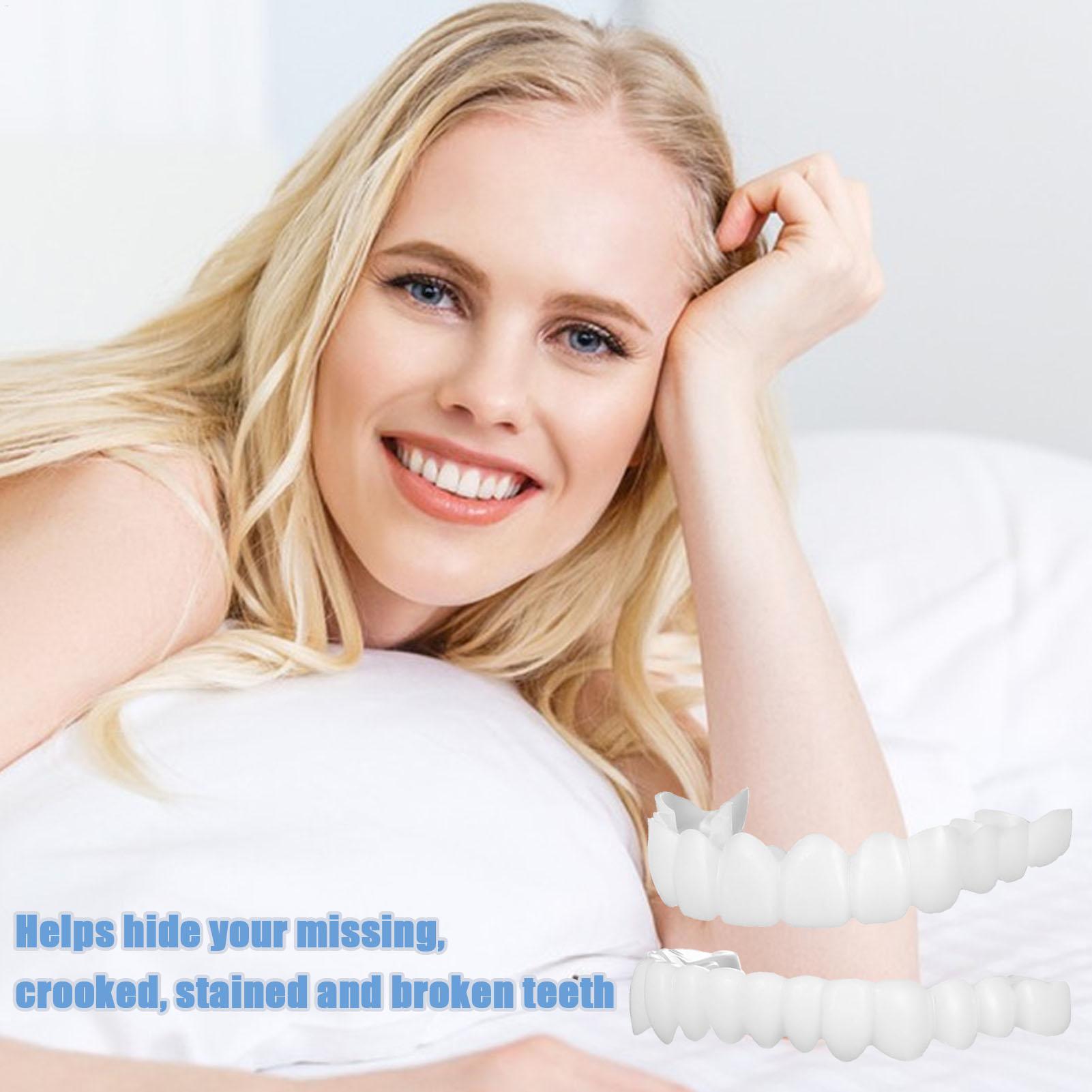 Penutup Gigi Palsu Atas Bawah, - Teeth Whitening With Braces ulasan dan harga
