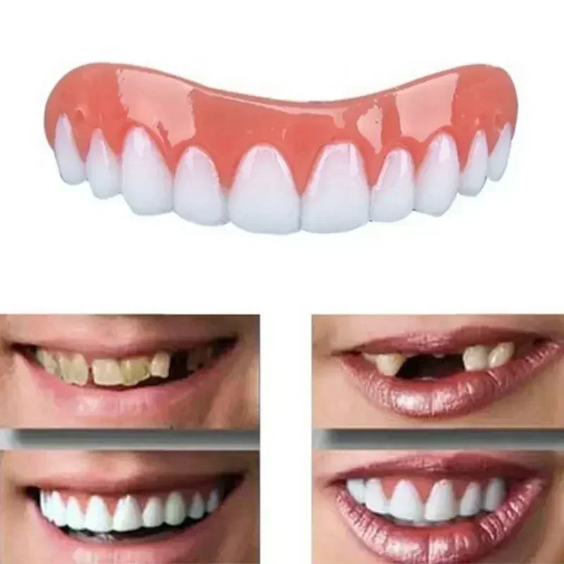 Gigi Palsu Silikon Baru, Venee - Teeth Whitening With Braces ulasan dan harga