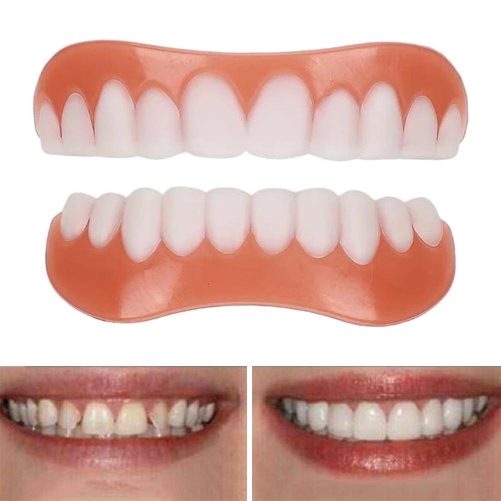 Gigi Palsu Silikon Baru, Venee - Teeth Whitening With Braces ulasan dan harga