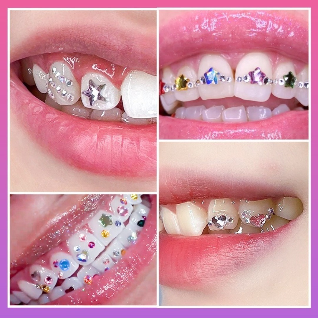 Perlengkapan Perhiasan Gigi DI - Tooth Gem Kit ulasan dan harga