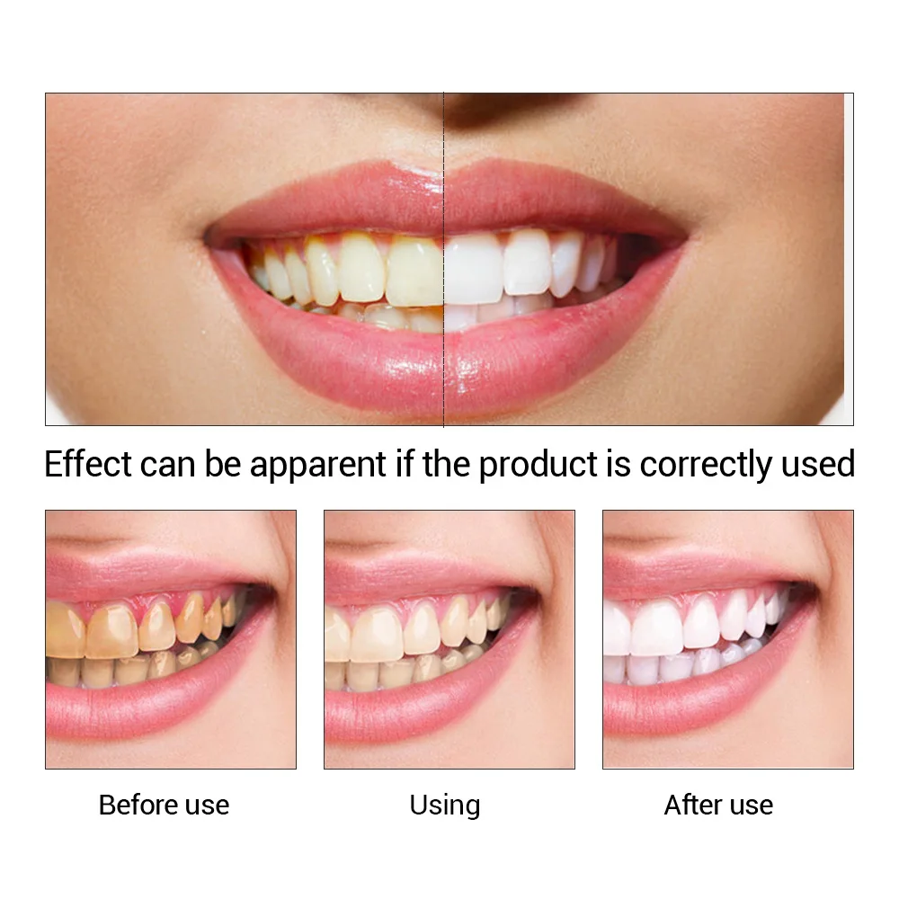 FTEENPLY Bubuk Esensi Pemutih  - Teeth Whitening Street ulasan dan harga