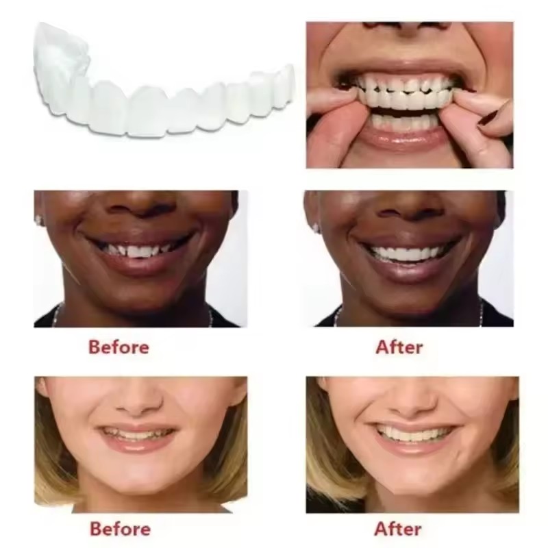 Veneer Gigi Pemutih Gigi Tirua - Teeth Whitening Kit ulasan dan harga