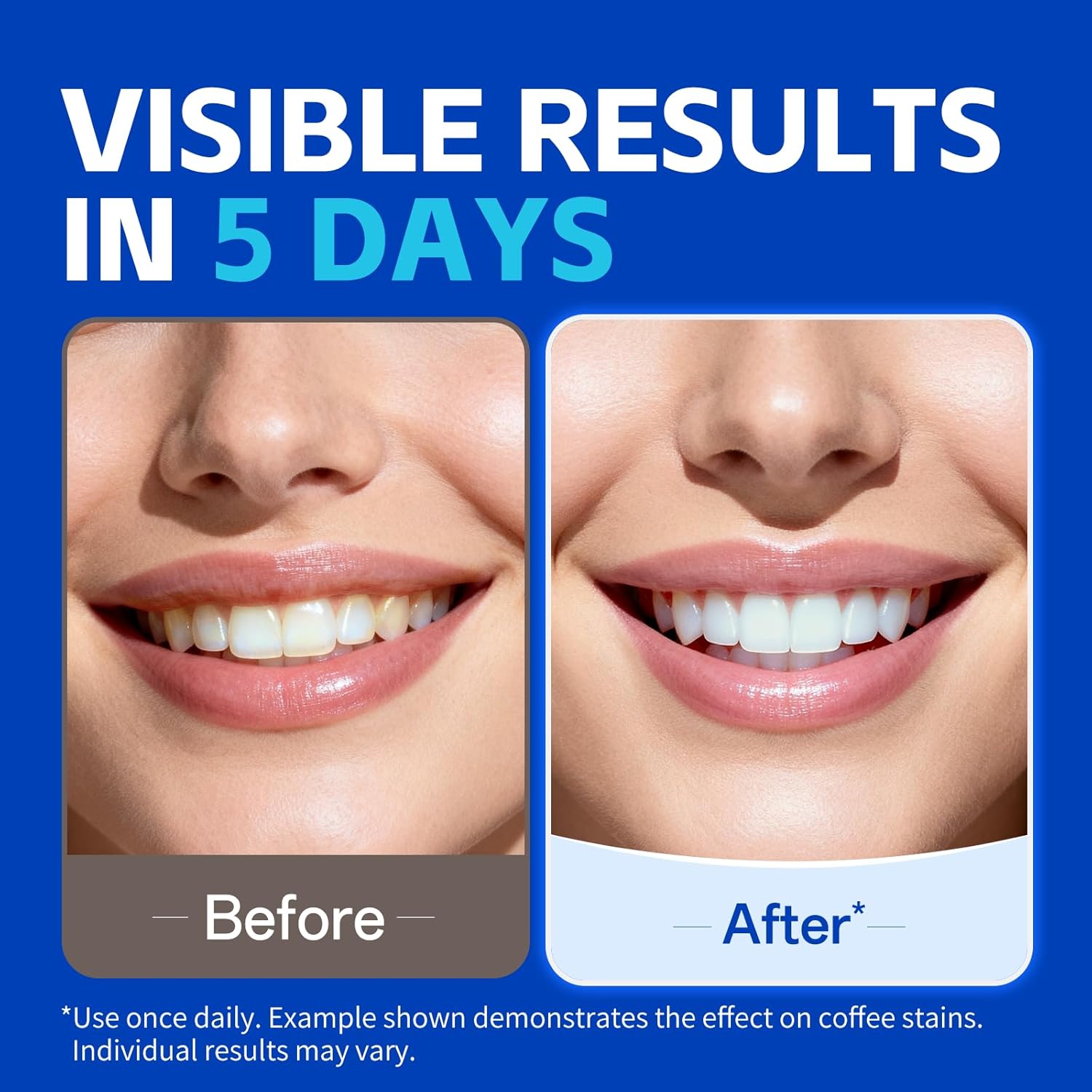 1/7 Pasang Strip Pemutih Gigi  - Teeth Whitening Street ulasan dan harga