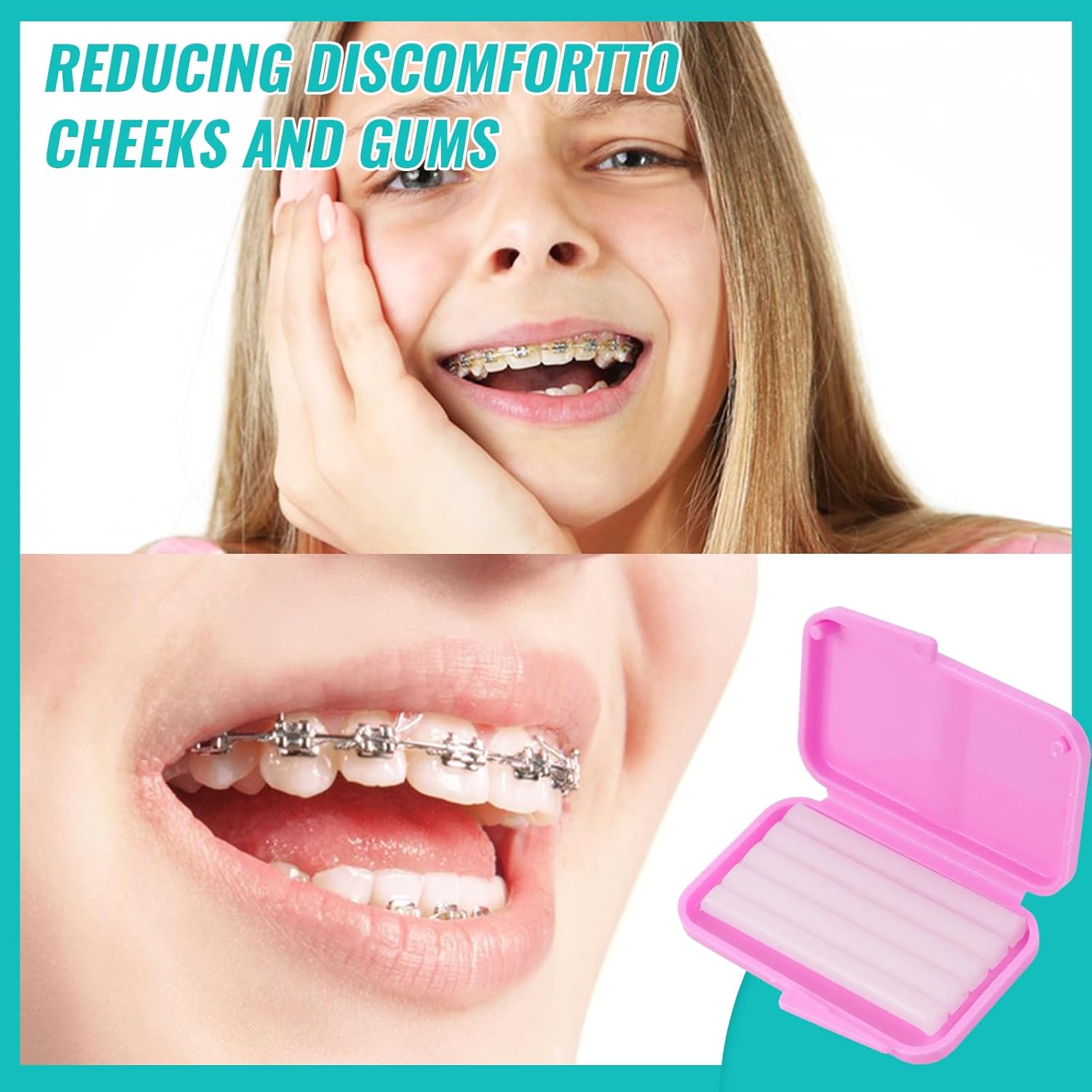 10 Kotak Lilin Ortodontik Gigi - Teeth Whitening With Braces ulasan dan harga