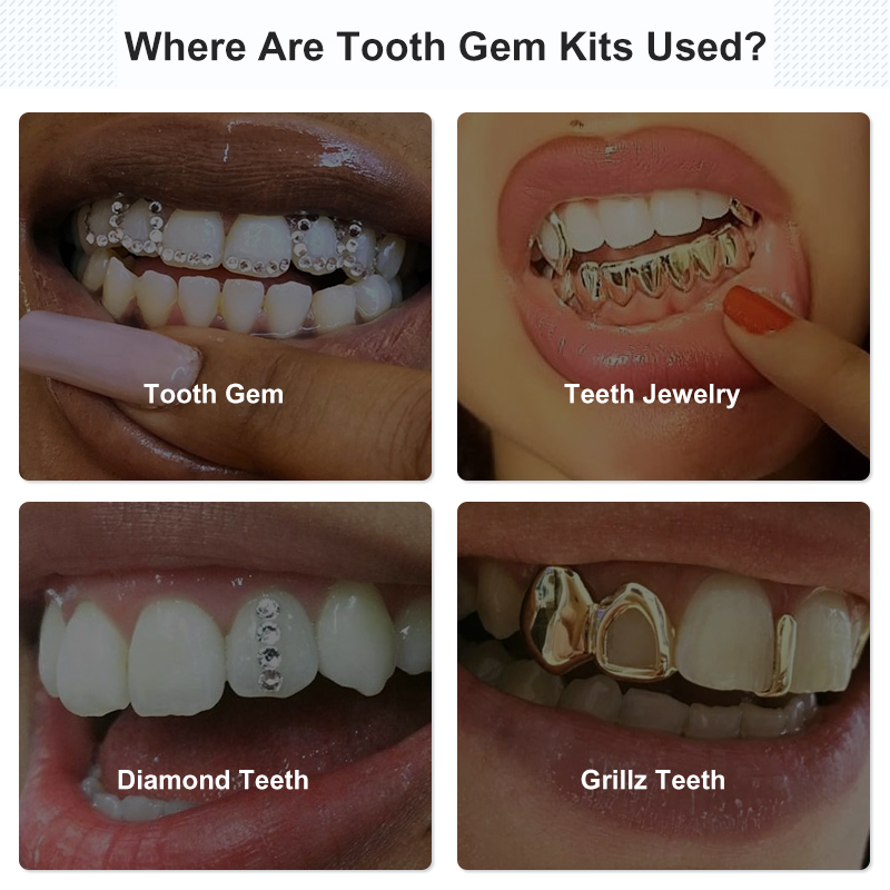 Set Peralatan Lem Permata Gigi - Tooth Gem Kit ulasan dan harga