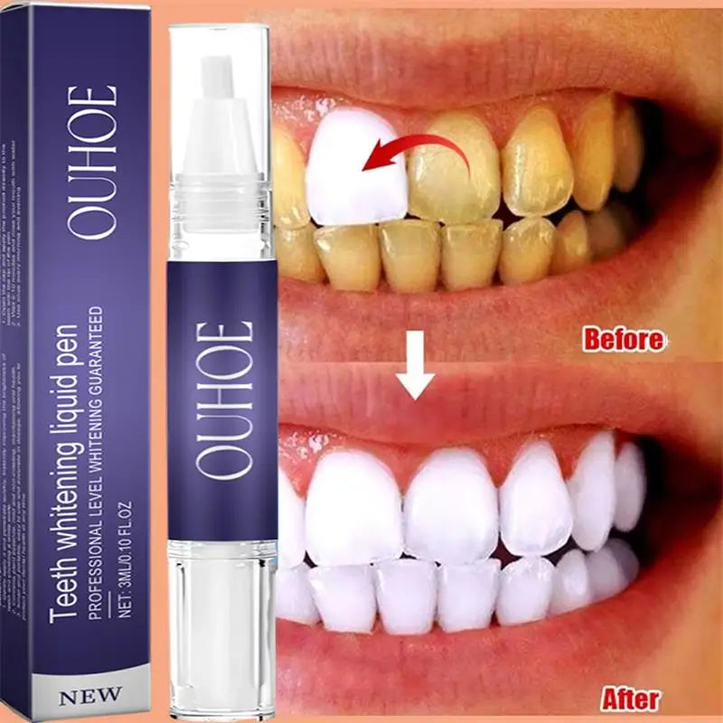 Pena Pasta Gigi Pemutih Gigi C - Whitening Pen Bleach ulasan dan harga