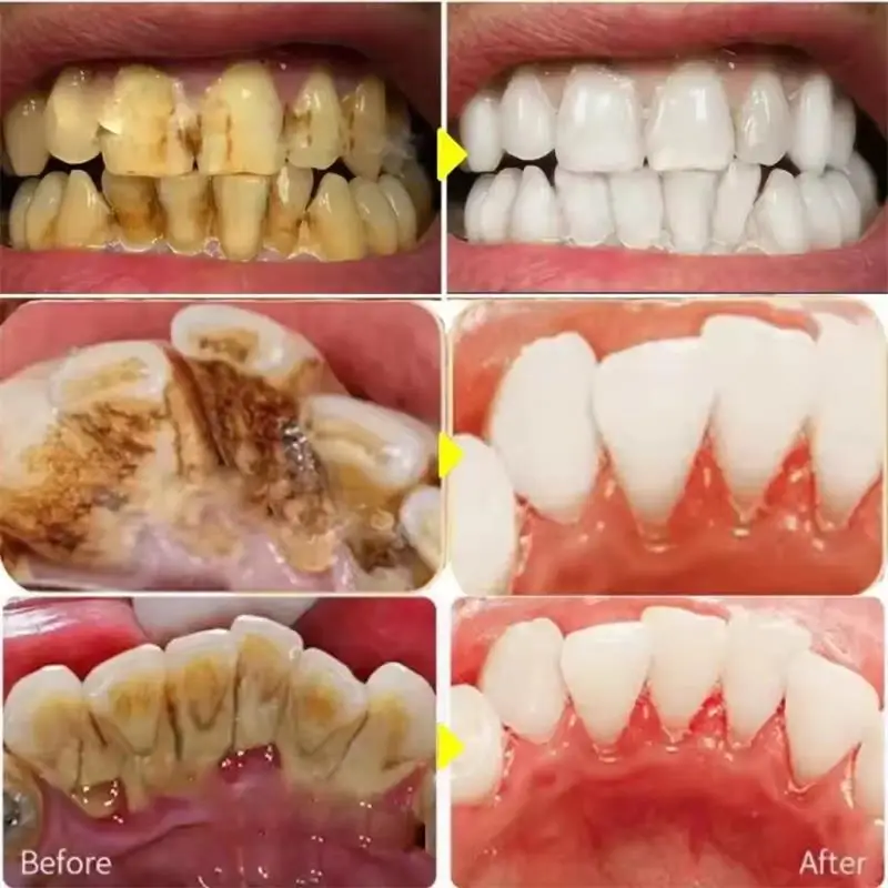 Pena Pasta Gigi Pemutih Gigi C - Whitening Pen Bleach ulasan dan harga